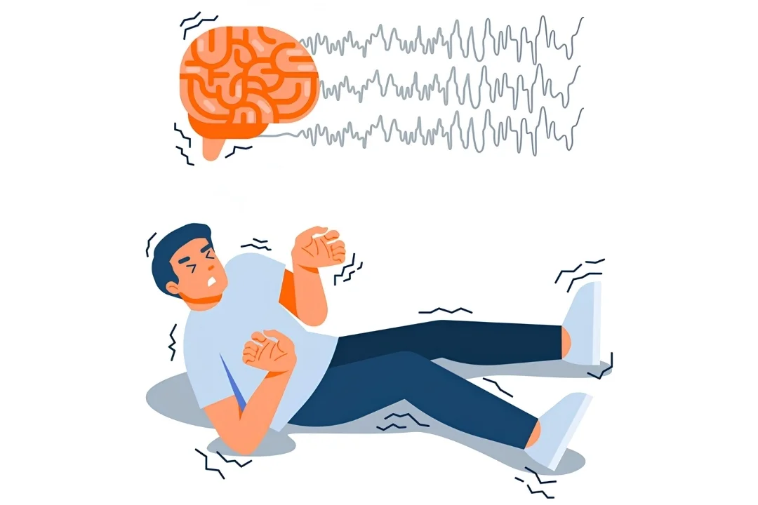 Epilepsy & Seizures: Myths vs Facts Every Pakistani Should Know​
