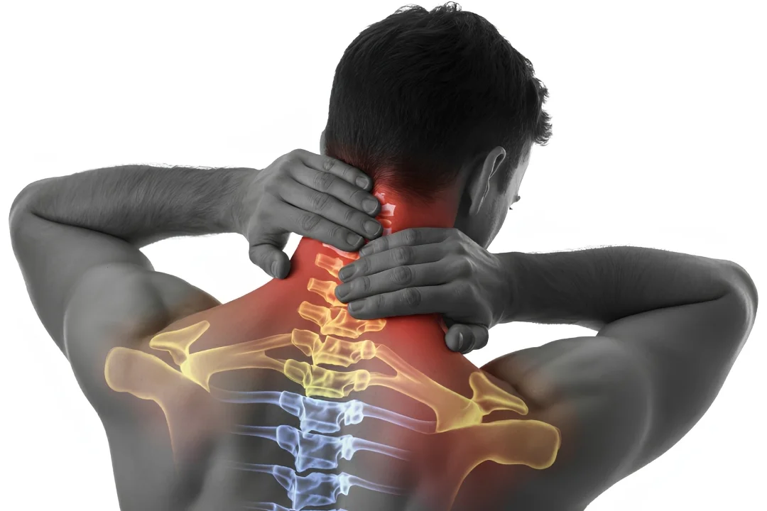 Cervical Spondylosis — Why Neck Pain Should Never Be Ignored